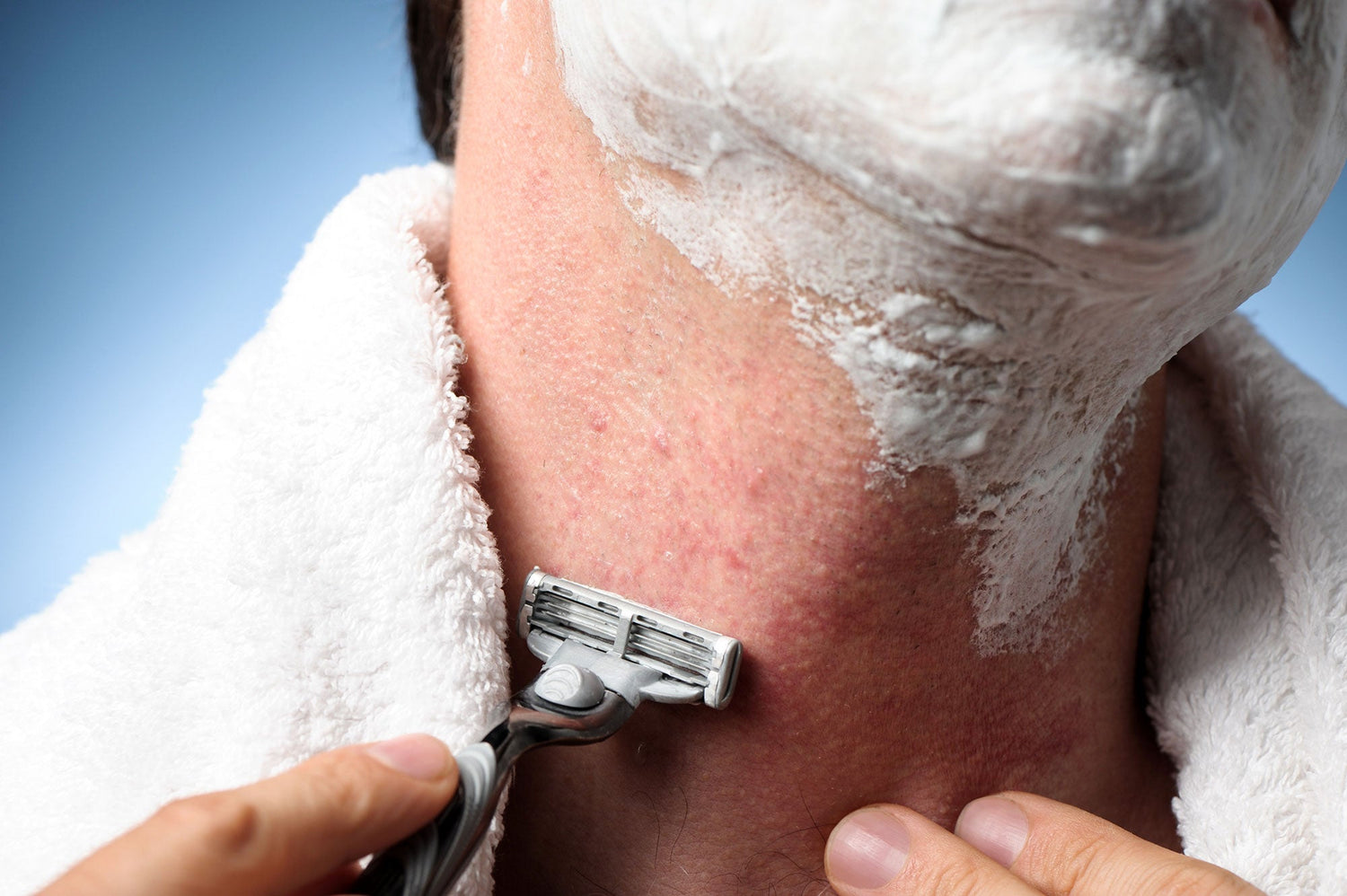 8 Tips on How to Get Rid of Razor Burn and Razor Rash Bossman Brands